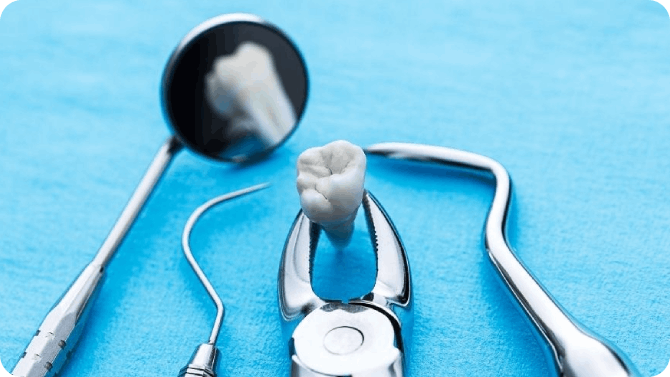 Tooth Extraction – Removal Of Impacted Teeth
