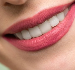 Aesthetic Dentistry (Hollywood Smile)