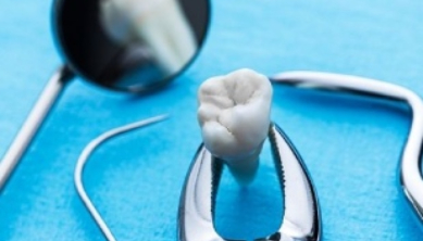 Tooth Extraction – Removal Of Impacted Teeth