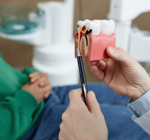 Endodonti Bölümüzde Uygulanan Kanal Tedavileri