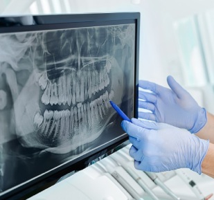 Oral Diagnoz Ve Radyoloji Kliniğimizde Uygulanan Hizmetler