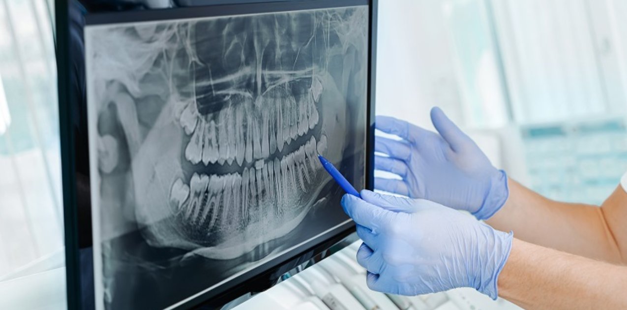 Oral Diagnoz Ve Radyoloji Kliniğimizde Uygulanan Hizmetler
